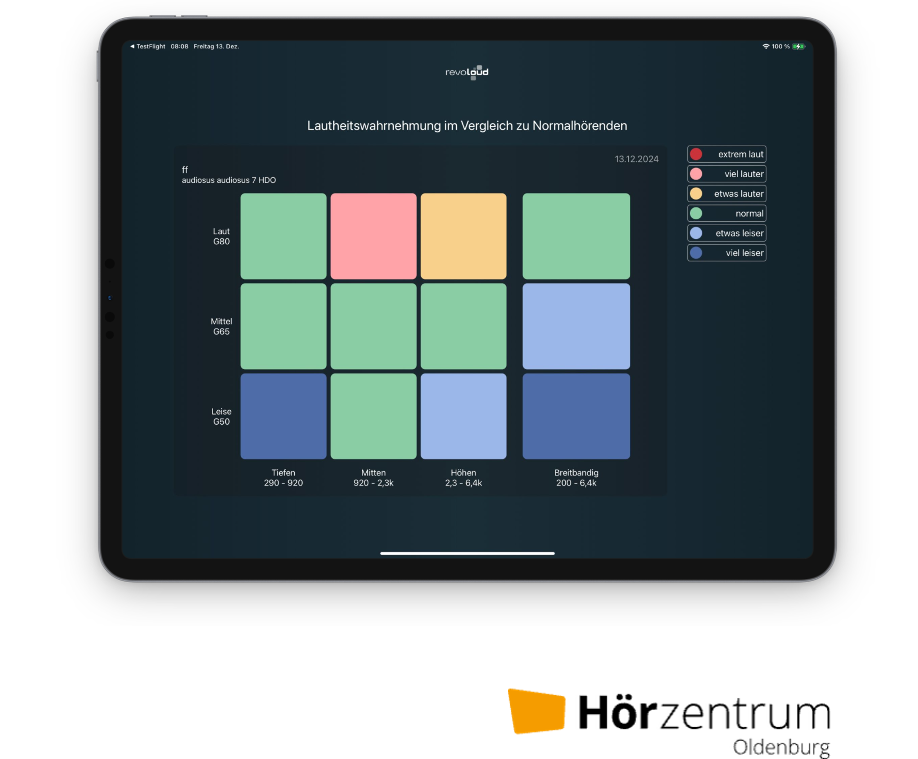 aurelia-revoloud-lead
